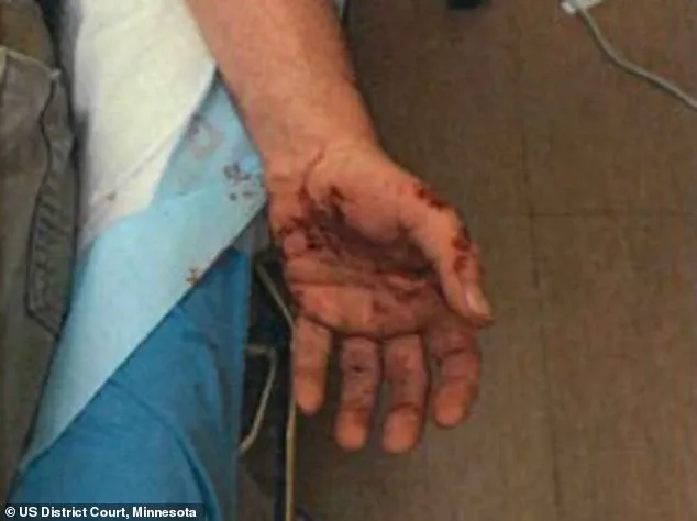 ICE Agent Jonathan Ross Testifies in Court: 'I Feared for My Life' During Encounter That Left Him with Scars, Months Before Fatal Shooting of Renee Good