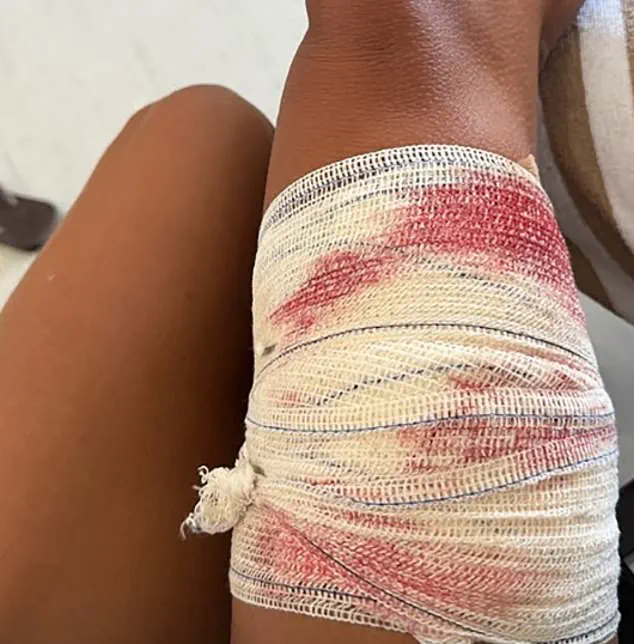 Emergency: Nurse Shark Attacks Freediver Near Fernando de Noronha in Shocking Video Footage