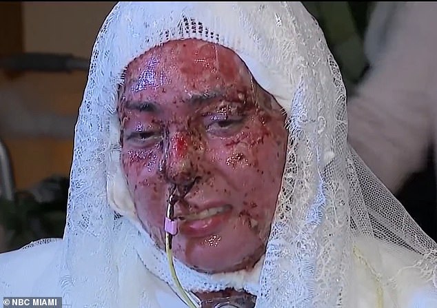 Triumph Over Tragedy: Arianna Esquiline's Hospital Chapel Wedding After Grill Explosion