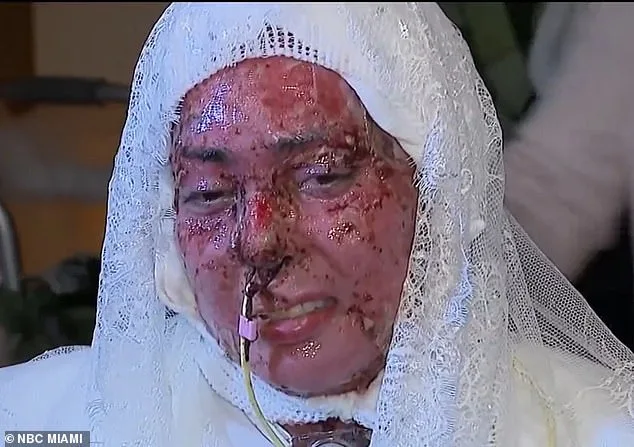 Triumph Over Tragedy: Arianna Esquiline's Hospital Chapel Wedding After Grill Explosion