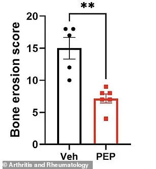 New Therapy for Arthritis: Peptide Treatment Offers Hope