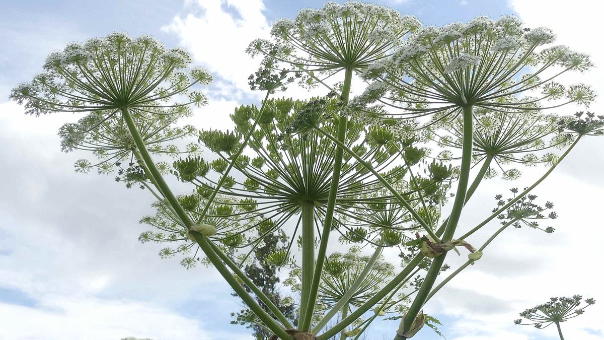 Six-year-old boy suffers severe burns after playing with giant hogweed.