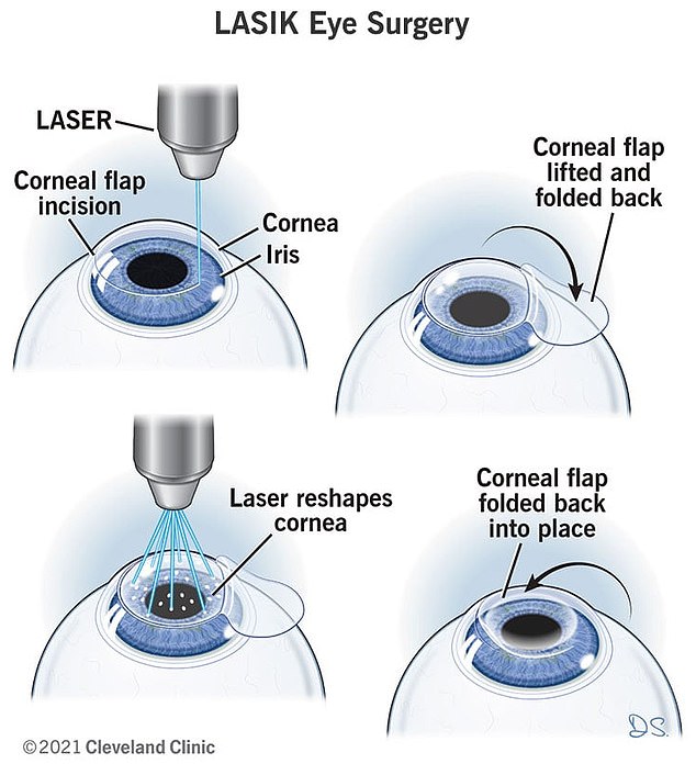 Police Officer Briana Coria Loses Vision After Laser Eye Surgery