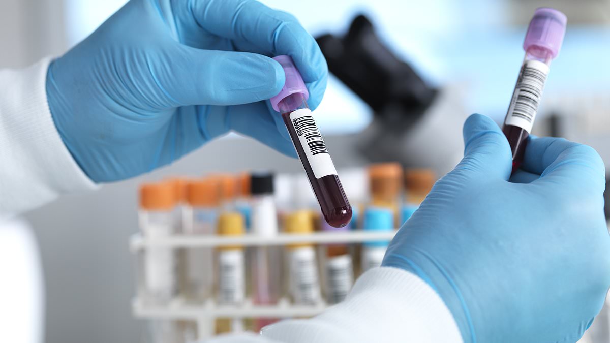 New Galleri blood test could save 30,000 lives annually by detecting cancer early.