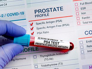 Prostate Cancer Survival Rates Vary Dramatically by U.S. Geography and Region.