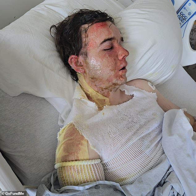 McDonald's worker hospitalized after coworker throws scalding oil during shift