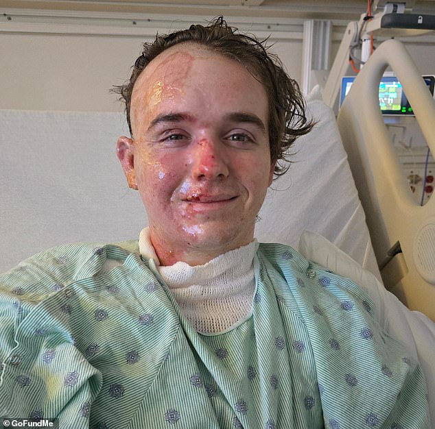 McDonald's worker hospitalized after coworker throws scalding oil during shift