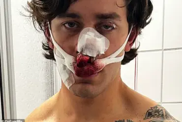 NYC Model-Paramedic Harmed in Dresden Attack While Protecting Women, GoFundMe Launched
