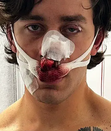 NYC Model-Paramedic Harmed in Dresden Attack While Protecting Women, GoFundMe Launched