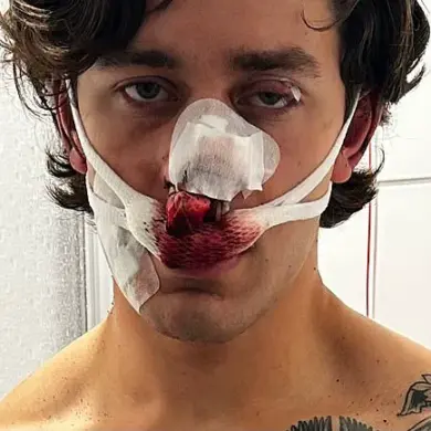 NYC Model-Paramedic Harmed in Dresden Attack While Protecting Women, GoFundMe Launched