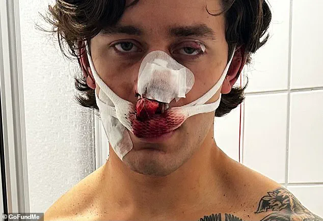 NYC Model-Paramedic Harmed in Dresden Attack While Protecting Women, GoFundMe Launched